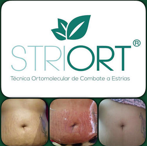 Tratamento de Striort